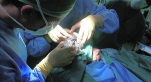 Médicos alicantinos consiguen erradicar los síntomas del párkinson con una nueva técnica