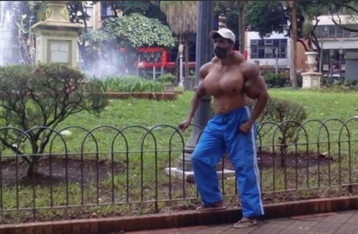 Valdir Segato, el &#039;Hulk&#039; brasileño que se inyecta aceite en los bíceps