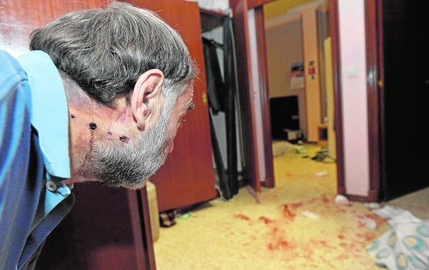 La víctima, con las heridas causadas por la bala, en su casa aún manchada de sangre.
