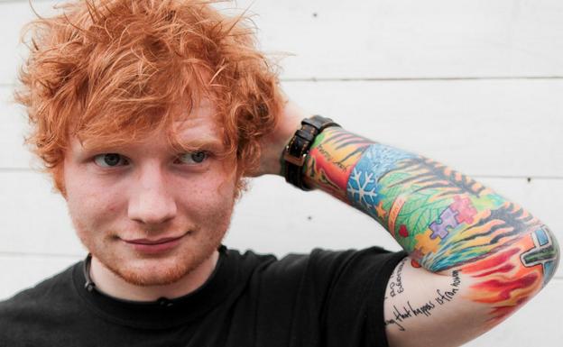 Ed Sheeran podría cancelar sus próximos conciertos debido a un accidente