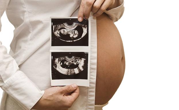 Mujer embarazada muestra una ecografía de su bebé. 