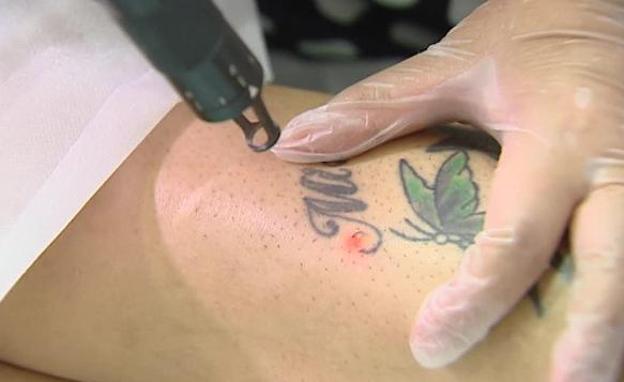 Cuánto cuesta borrar un tatuaje?