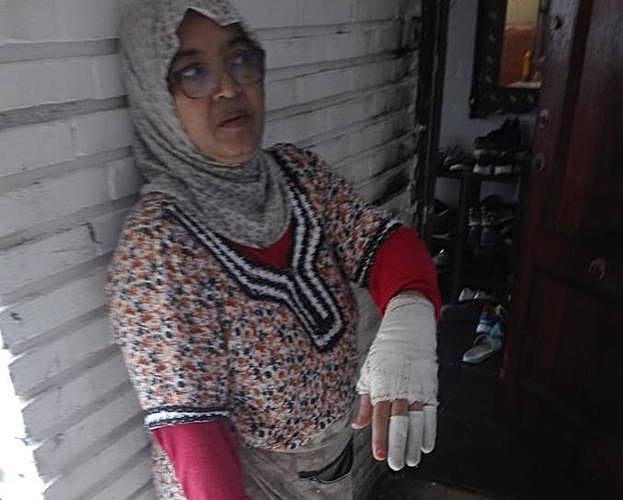 Naima, suegra de la víctima, también sufrió quemaduras al socorrerla.