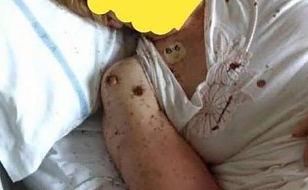 La imagen de la paciente ha causado indignación. 