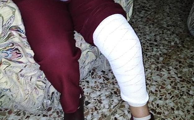 Vendaje que lleva en la pierna la anciana asaltada. 