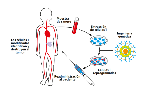 Infografía que representa el funcionamiento de las terapias CAR-T.