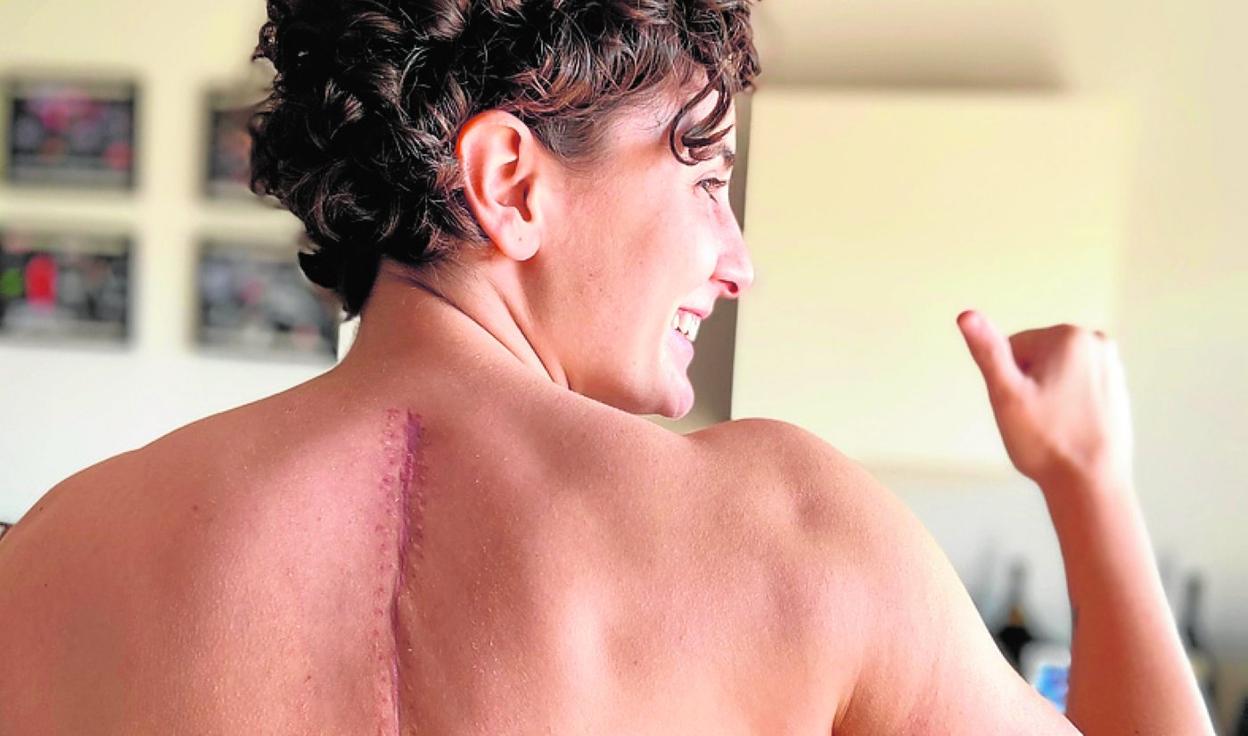 Ana Carrasco, ayer, mostrando su cicatriz curada. 