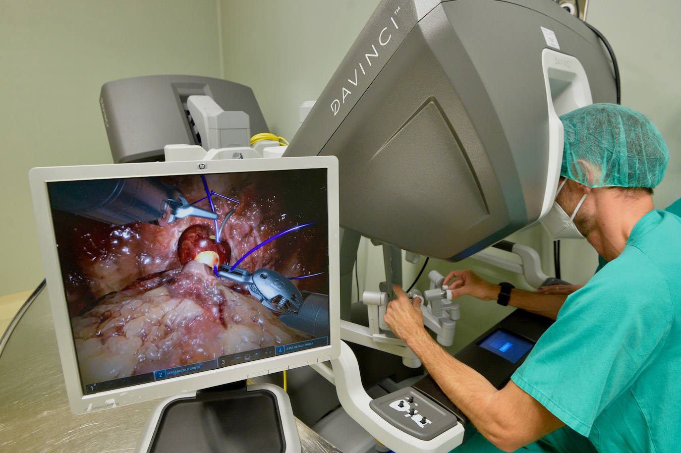 Fotos: Un robot en el quirófano