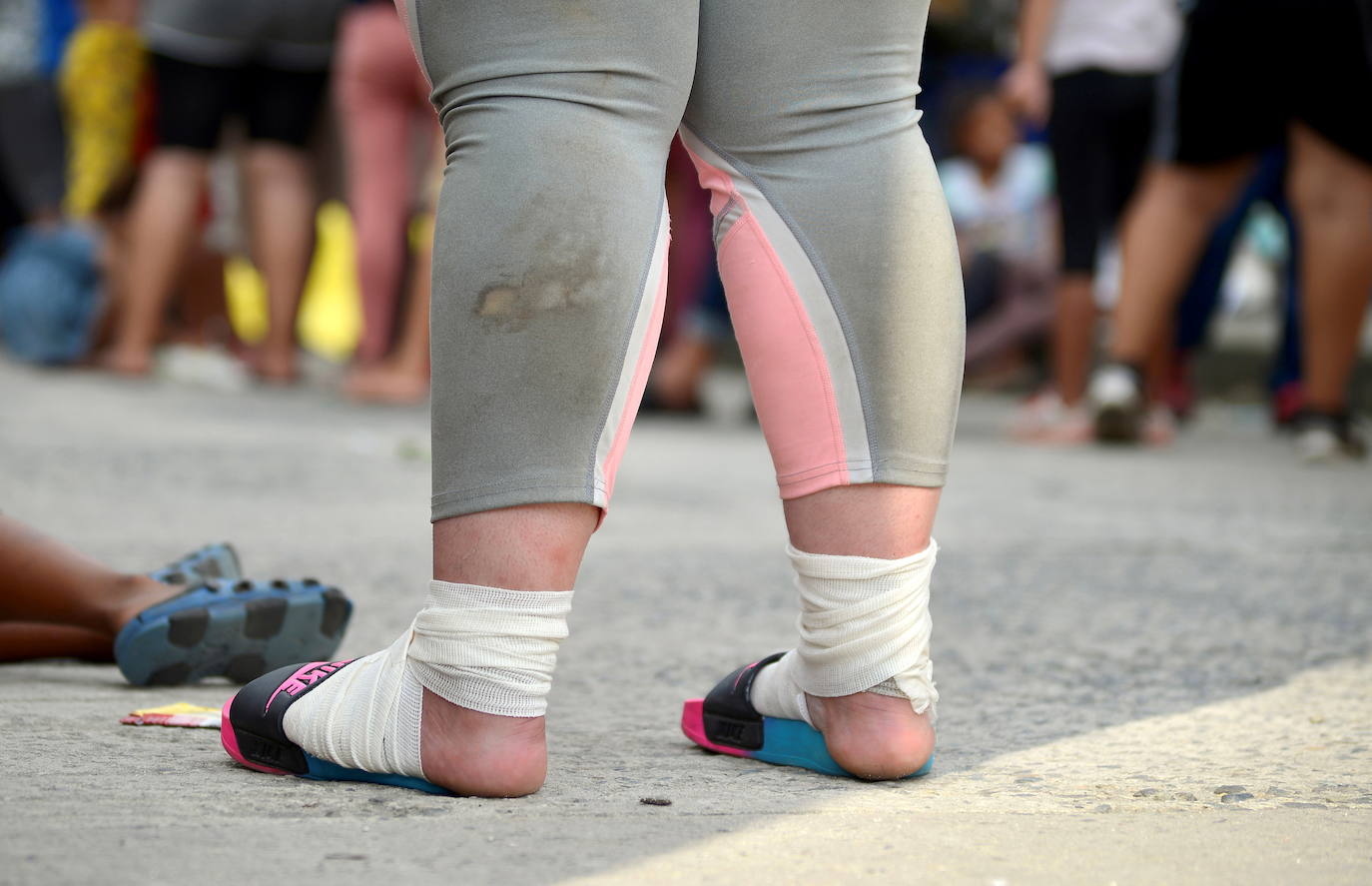 Fotos: Vendas y reposo