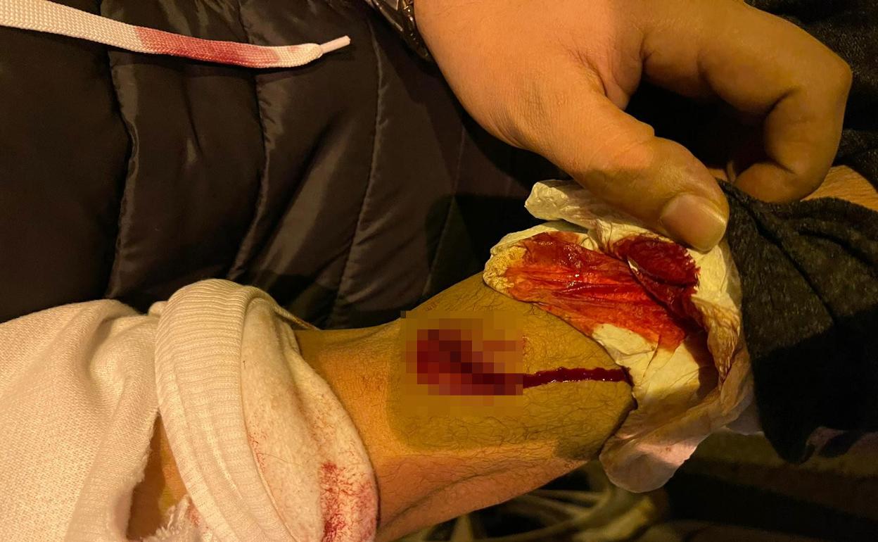 Un herido muestra el corte que sufrió en un brazo durante la pelea.