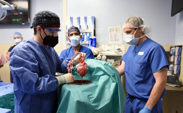 Los médicos, en el momento de realizar el trasplante.