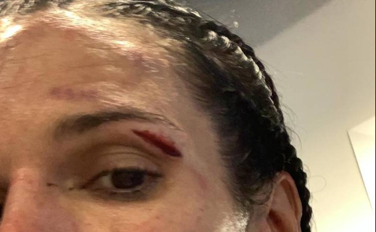 Las heridas de 'Mari Bicho' tras bajar del ring. 
