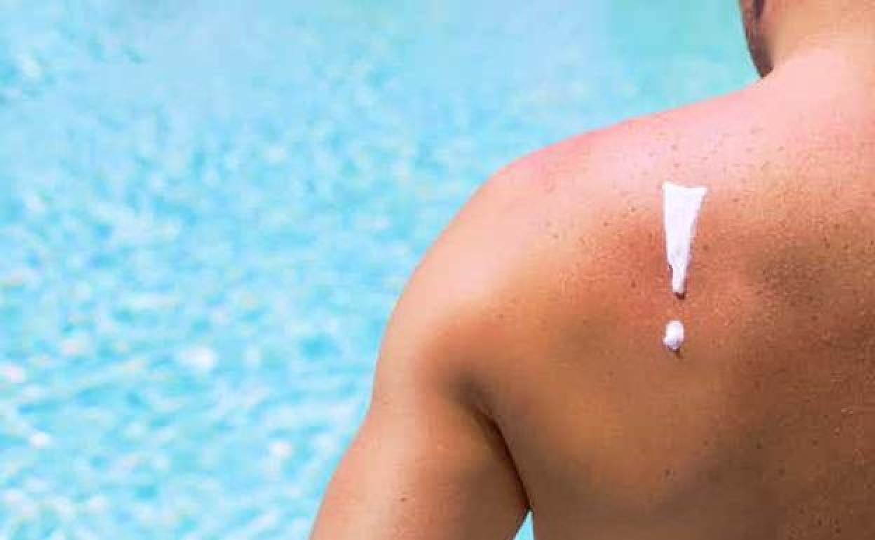 4 trucos para evitar que la piel se pele después de tomar el sol