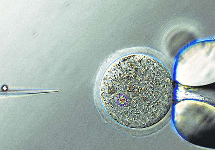 Imagen principal - Microinyección de un ovocito de ratón.