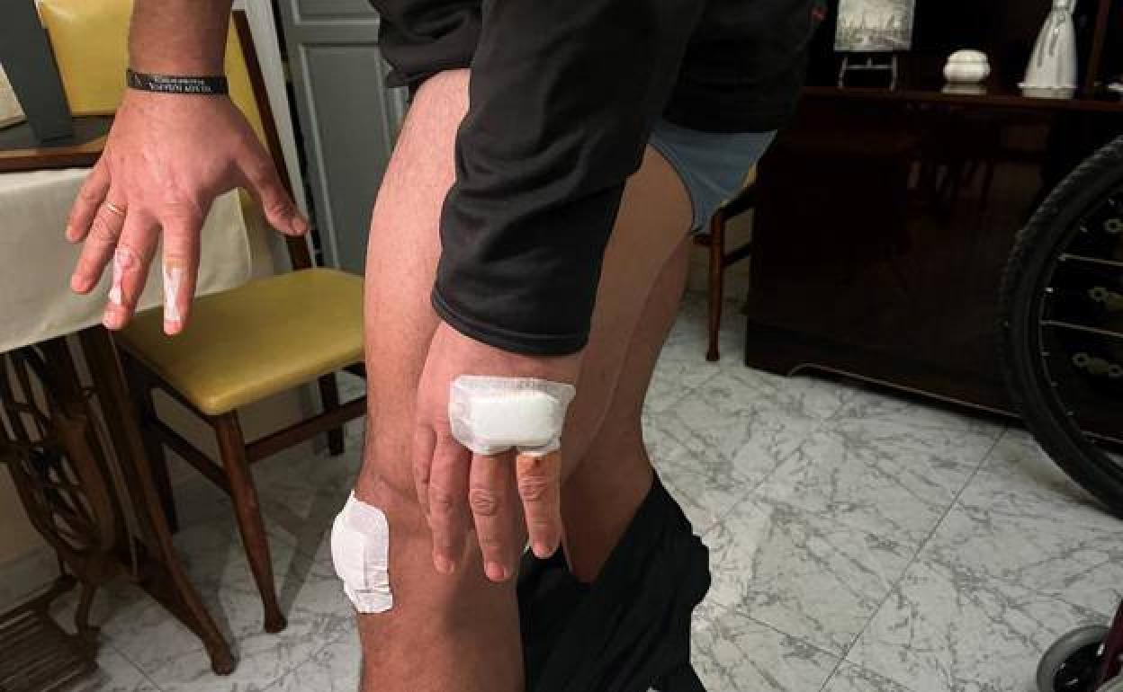 Heridas del Guardia Civil atacado en su casa de Cieza.