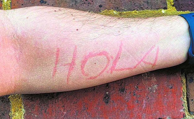 Imagen del brazo de Pablo segundos después de 'dibujar' un 'HOLA'.