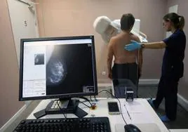 Una mujer durante la realización de una mamografía.