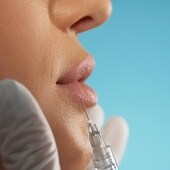 Un médico estético muestra las consecuencias de abusar del aumento de labios.