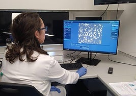 Estudio microscópico de células tumorales de cáncer de pulmón.