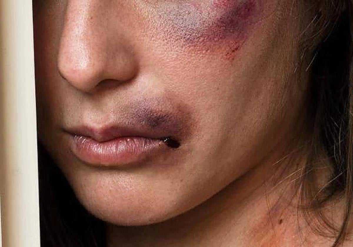 Imagen de archivo de una mujer con heridas tras una agresión.