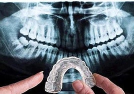 El error que muchos cometen a la hora de limpiar su férula.