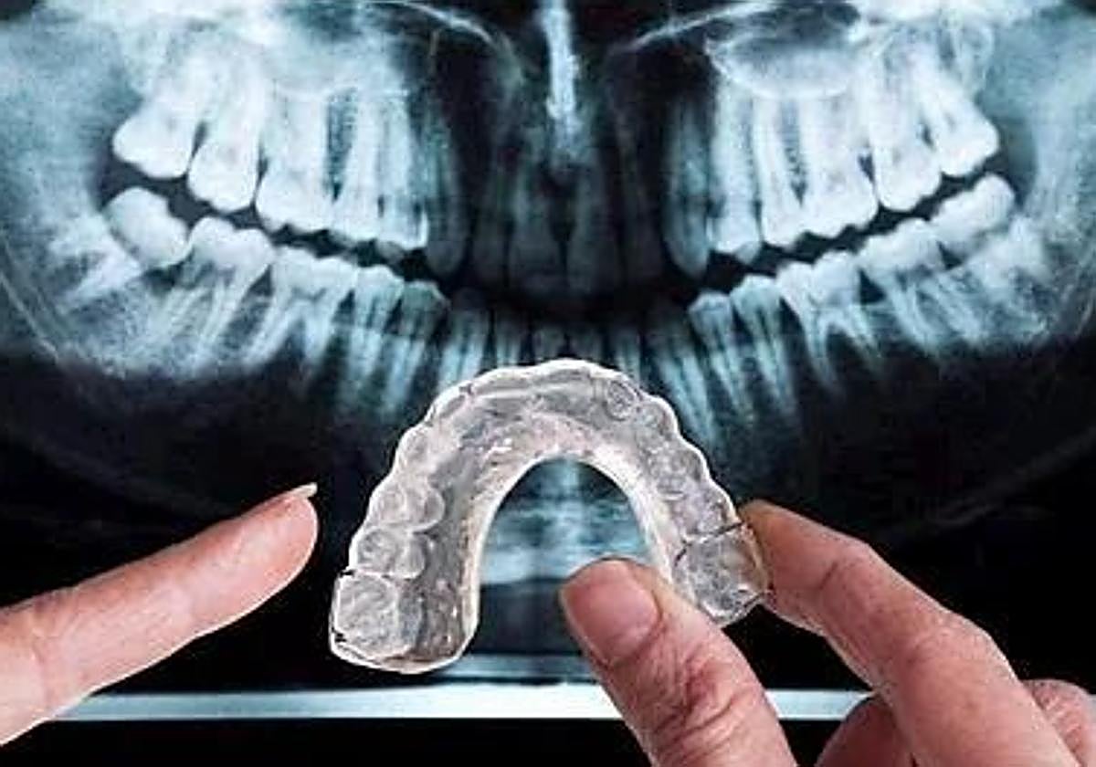 El error que muchos cometen a la hora de limpiar su férula.