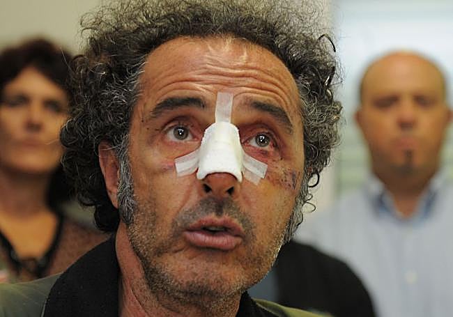 El agredido sufrió varias lesiones durante la actuación del agente tras la huelga general.