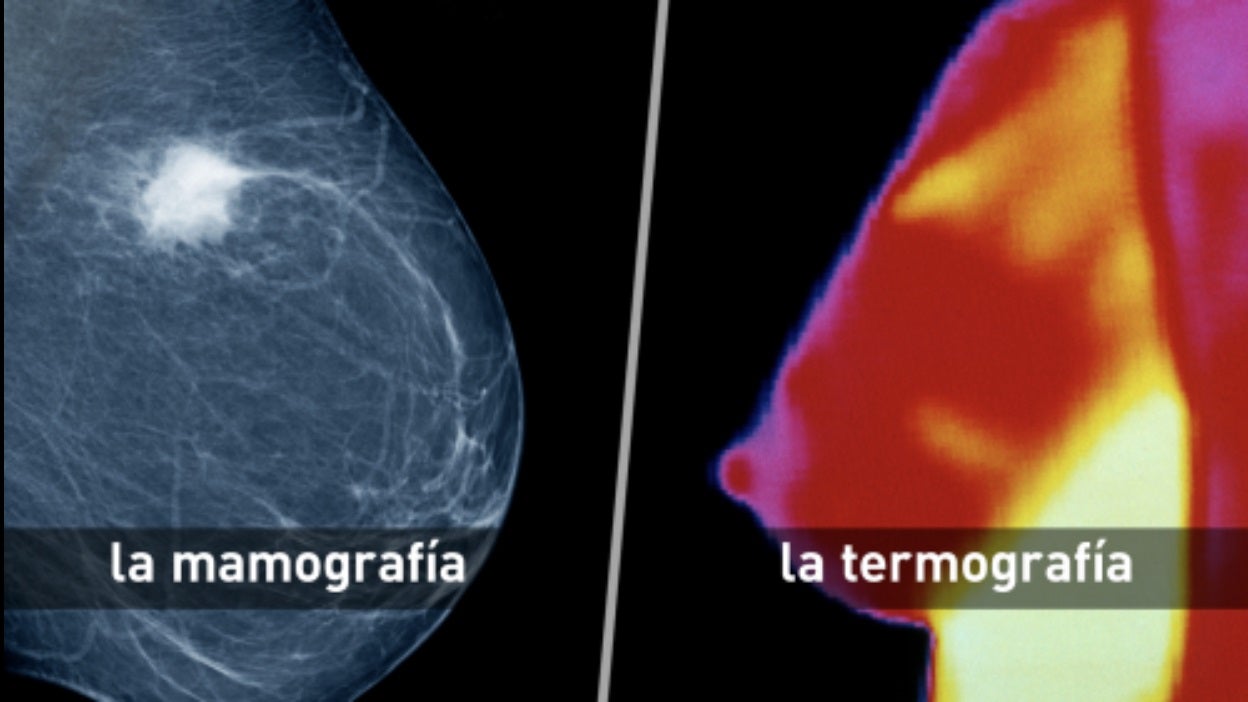 La mamografía revela las estructuras internas de la mama y puede mostrar lesiones sospechosas –nótese la masa blanca brillante–, mientras que la termografía solo refleja patrones de calor en la superficie de la piel. La termografía no detecta microcalcificaciones ni tumores profundos, por lo que usarla como reemplazo a la mamografía puede provocar peligrosos falsos negativos.