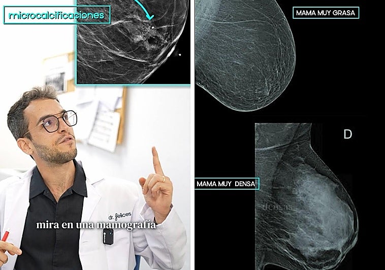 El doctor Felices responde: ¿debemos tener miedo a las mamografías? ¿Por qué no se usan pruebas sin radiación?