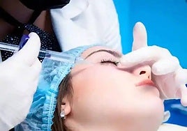 Una paciente recibe un tratamiento estético.