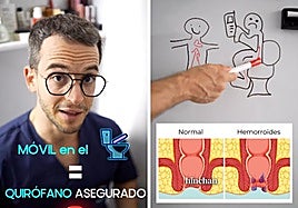 El doctor Felices responde: cuando la cisterna se convierte en agujero negro