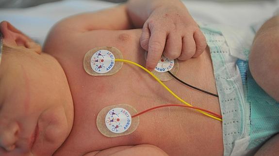 BabyDuino quiere medir pulsaciones, temperatura o humedad para controlar su estado