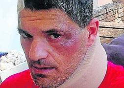 'Frank de la jungla' sufre un grave accidente de helicóptero y se parte  varios huesos | La Verdad