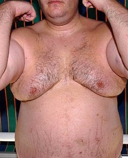 El supuesto espía muestra las magulladuras. / ELISEO