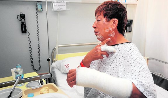 Mari Inés, la mujer que sufrió las lesiones más graves, hospitalizada en La Arrixaca. 