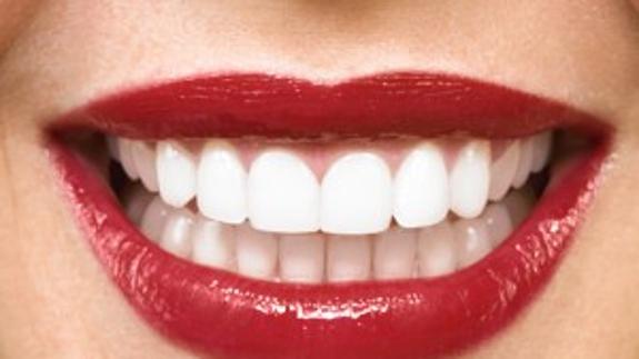 Si tu obsesión es lucir una sonrisa como esta, podrías sufrir 'blancorexia'