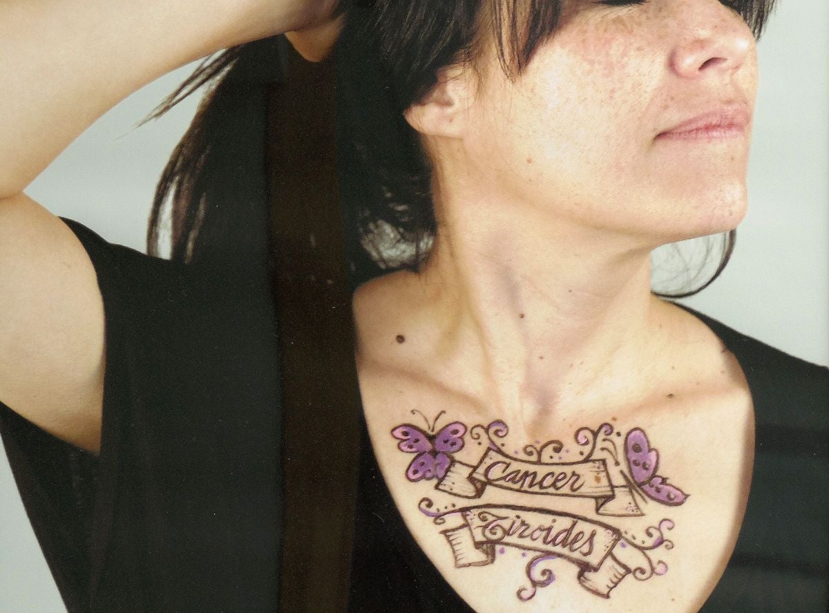 Historias de supervivencia