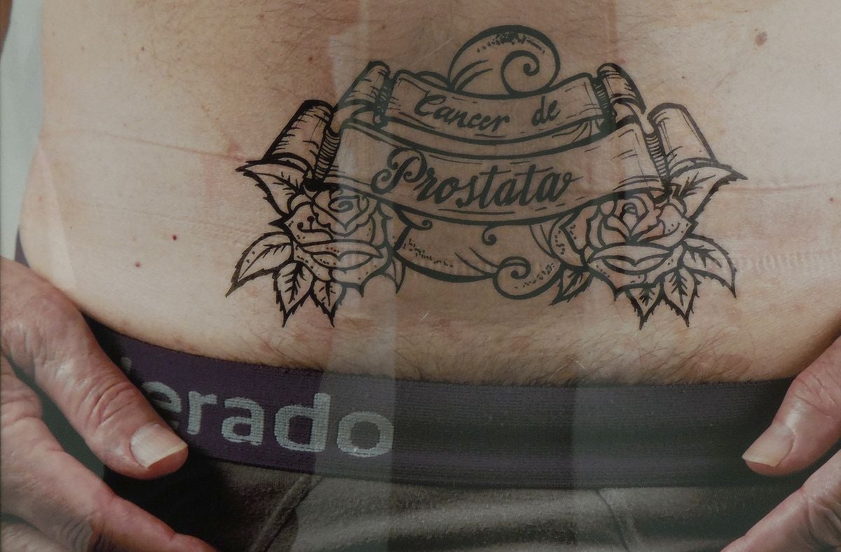 Historias de supervivencia