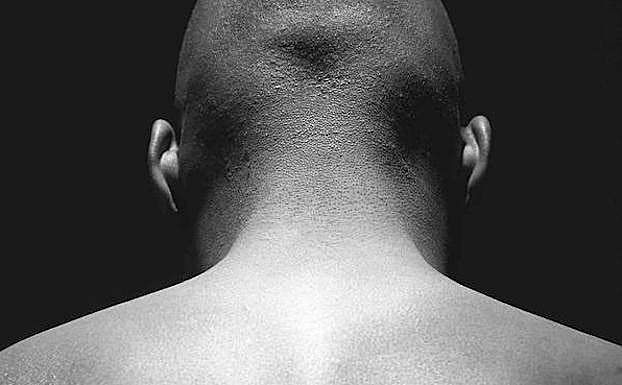 El esguince cervical afecta a más de 25.000 españoles cada año. 