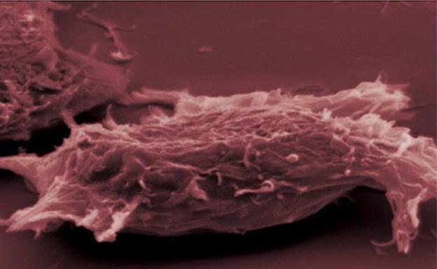 Visión microscópica de células cancerígenas.