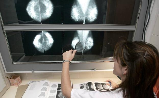 Una radióloga examina unas mamografías en la sección de Radiología del Hospital Comarcal Santiago Apóstol, en Miranda de Ebro. 