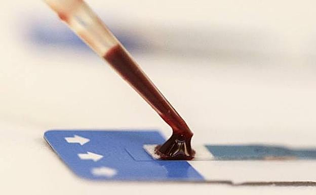 Los nuevos casos se producen por transmisión sexual.