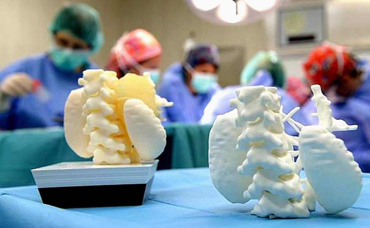 Recreación por impresora 3D de la parte afectada por un tumor del cuerpo de un niño de 5 años. 