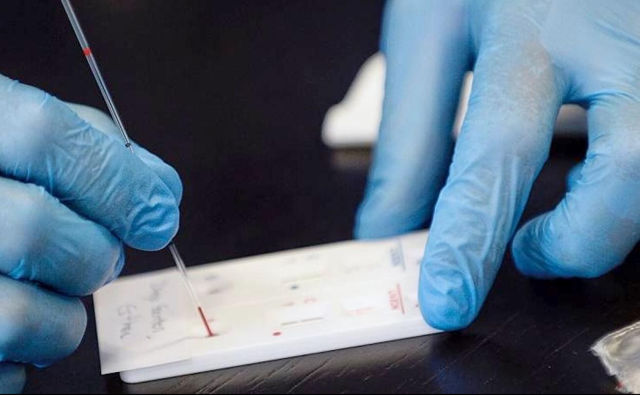 Test para la detección del coronavirus COVID-19.