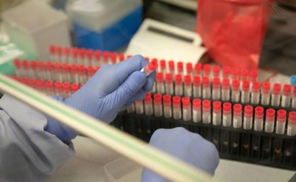 Pruebas de test de la covid.