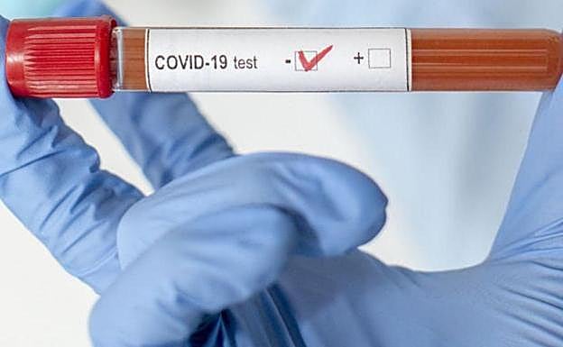 Muestra de sangre con coronavirus. 