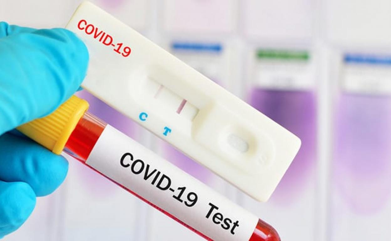 Imagen de un test de coronavirus.