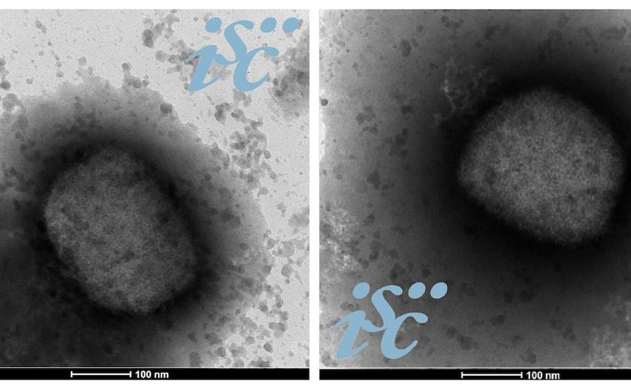 Dos imágenes del virus de la viruela del mono.