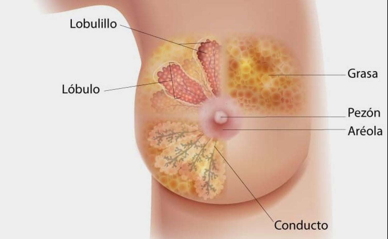 Una diagrama de la vista de sección transversal de la mama, que se enfoca en los lobulillos, los lóbulos, el conducto, la aréola, el pezón y la grasa. 