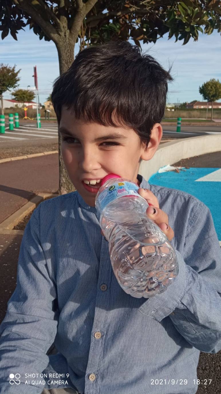 Adam, el niño leonés con autismo, que tiene que pasar por quirófano cada vez que necesita ir al dentista.